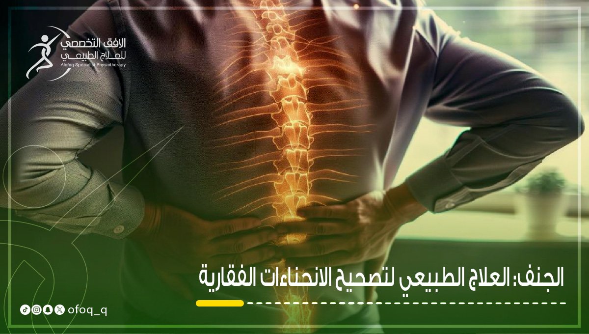 علاج الجنف علاج طبيعي في القصيم بريدة