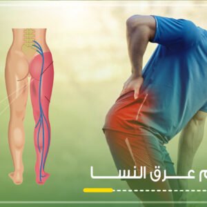 علاج-عرق-النسا-في-الافق-التخصصي-للعلاج-الطبيعي-في-القصيم-بريدة
