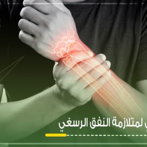 علاج-طبيعي-لمتلازمة-النفق-الرسغي في الافق التخصصي القصيم بريدة